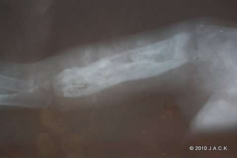 X-ray Tommy's arm